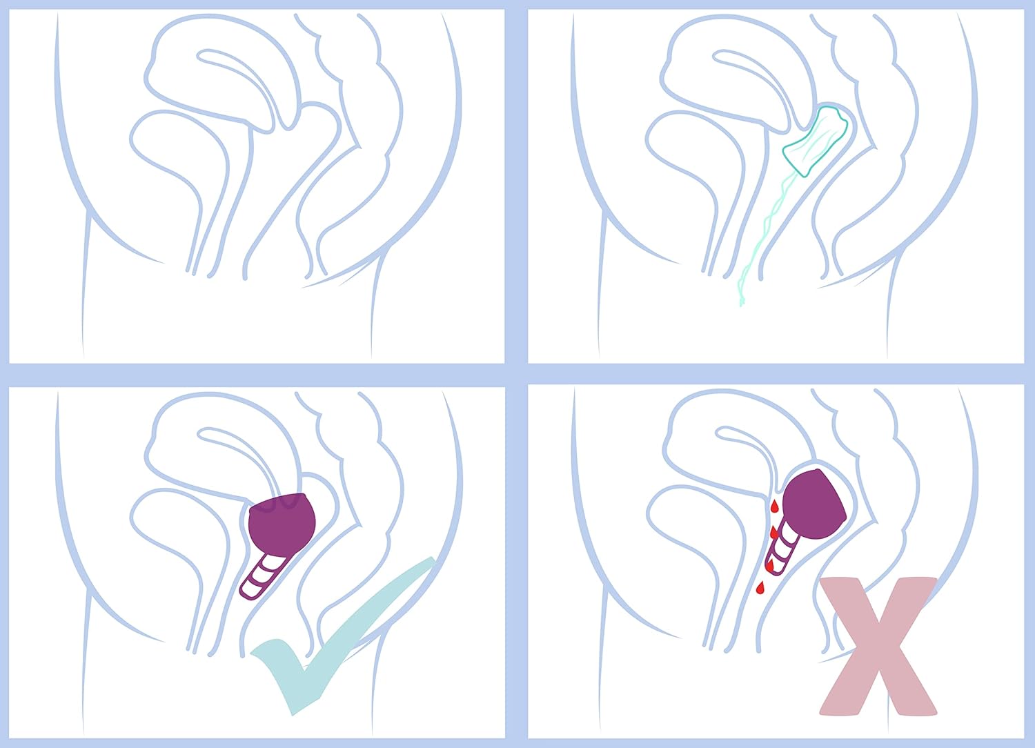 Merula Cup Galaxy (Violet) - The one Size Menstrual Cup