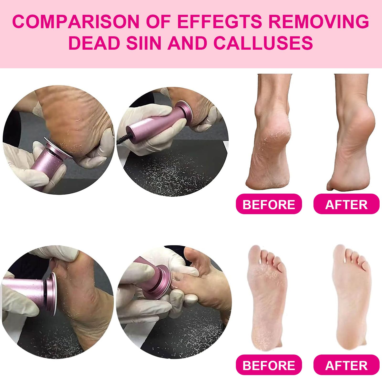 Removedor eléctrico de callos de pies, herramienta profesional de pedicura con 60 papeles de lijado, color rosa