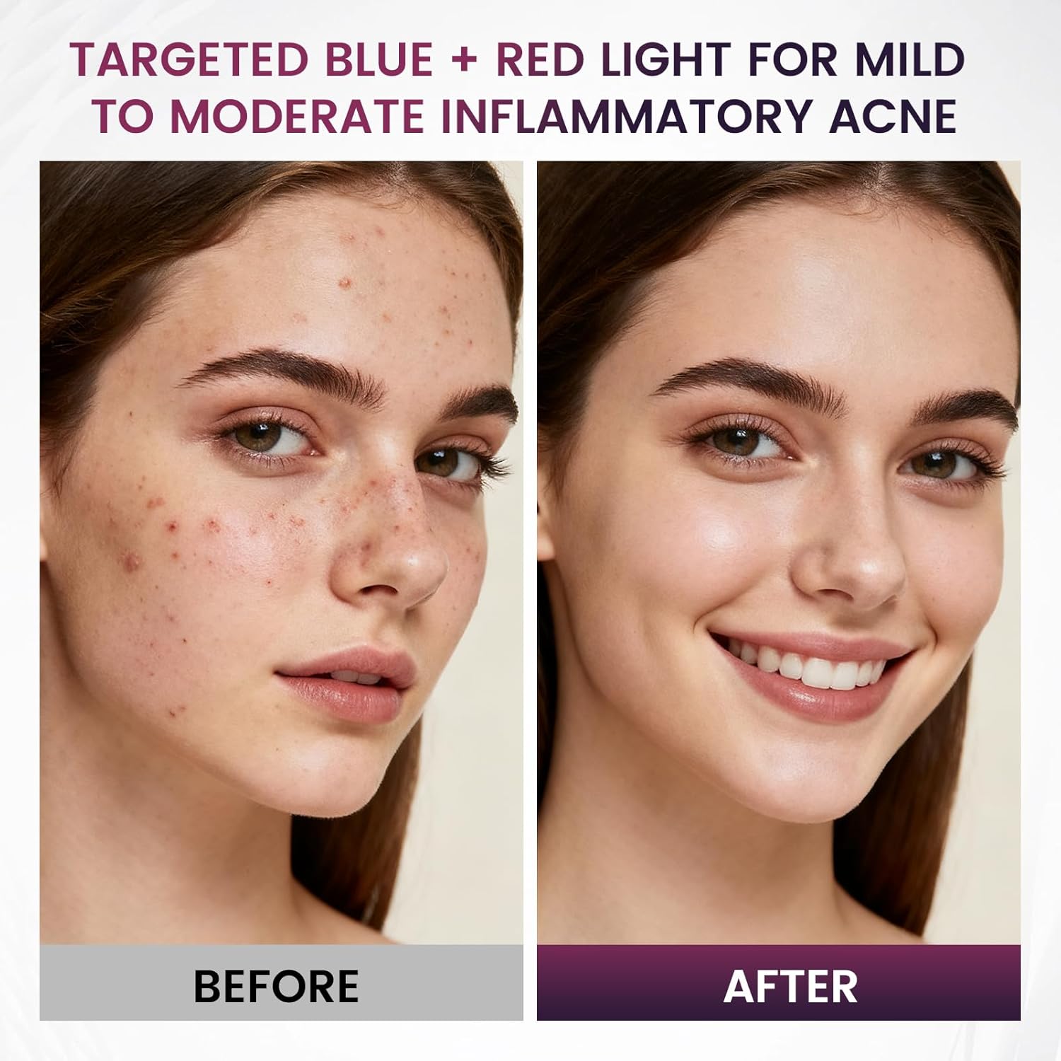 Red Light Therapy for Face, 850nm Infrared LED Face Mask Light Therapy with 280 LEDs, Cordless Red Light Therapy Device with 5 & 10 Min Timer, FDA Cleared Light Therapy Mask - Image 9