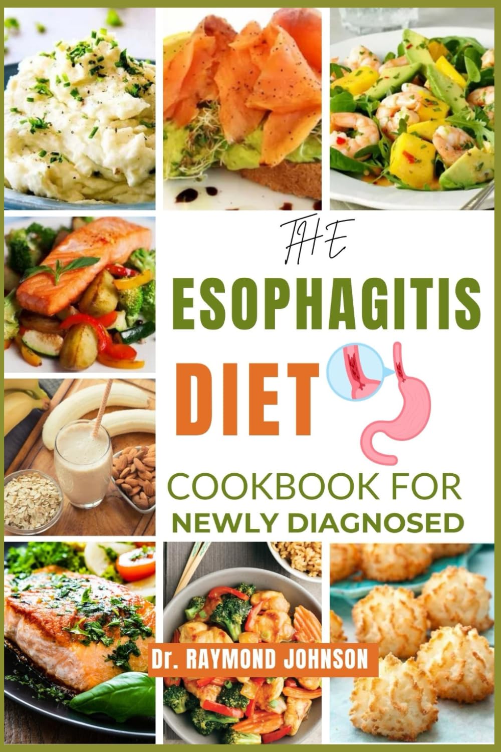 THE ESOPHAGITIS DIET COOKBOOK FOR NEWLY DIAGNOSED: Beginner-Friendly Recipes and Meal Plans for Managing Esophagitis and Living Well.