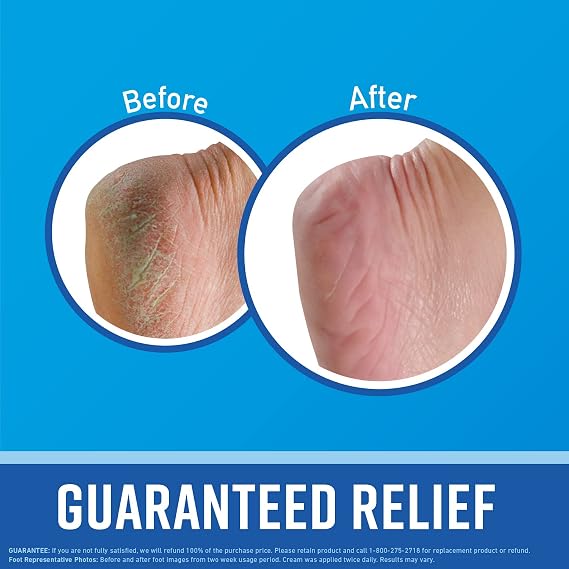 O'Keeffe's for Healthy Feet Foot Cream;  Relief for Extremely Dry; Cracked Feet; Instantly Boosts Moisture Levels; 3.2 Ounce Jar; (Pack of 3)