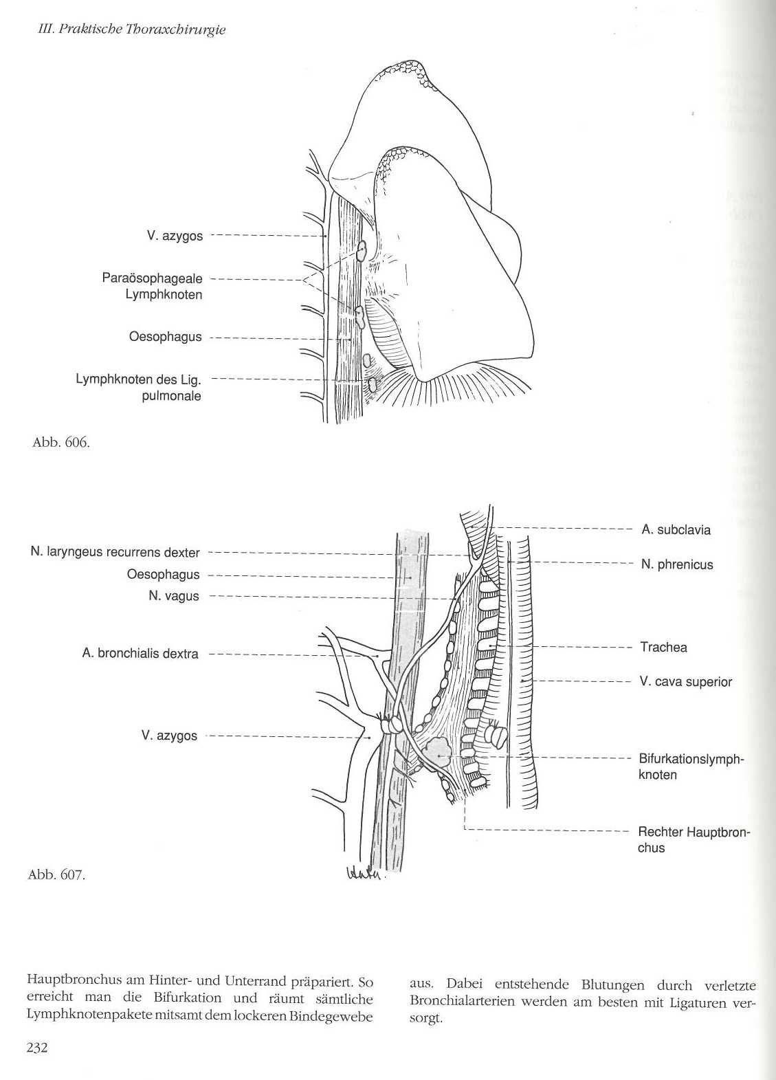 Atlas der Thoraxchirurgie