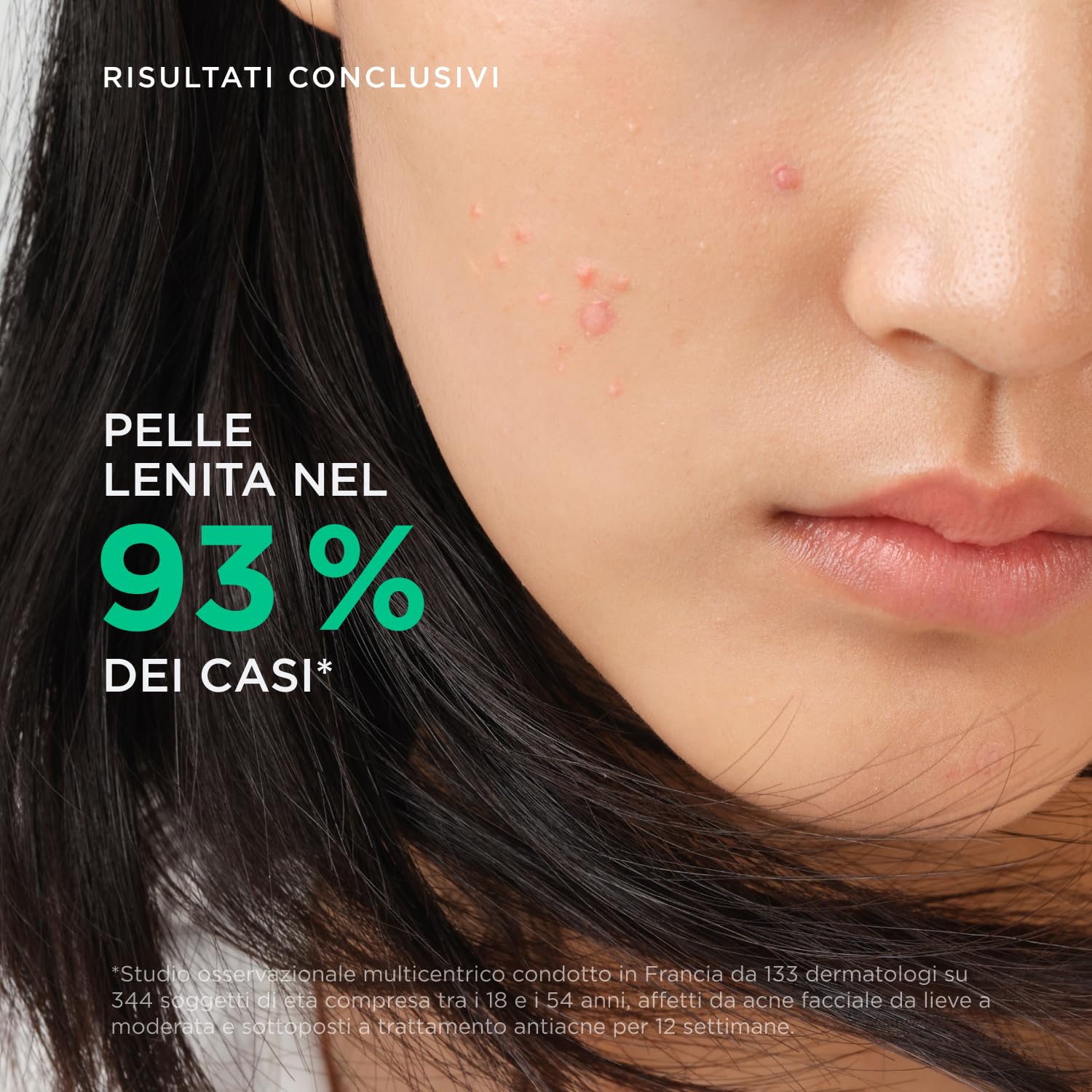 BIODERMA Sébium Hydra - Trattamento Idratante e Nutriente - Per la Pelle a Tendenza Acneica - Compensa gli Effetti Collaterali dei Trattamenti Antiacne - Tubo da 40 ml