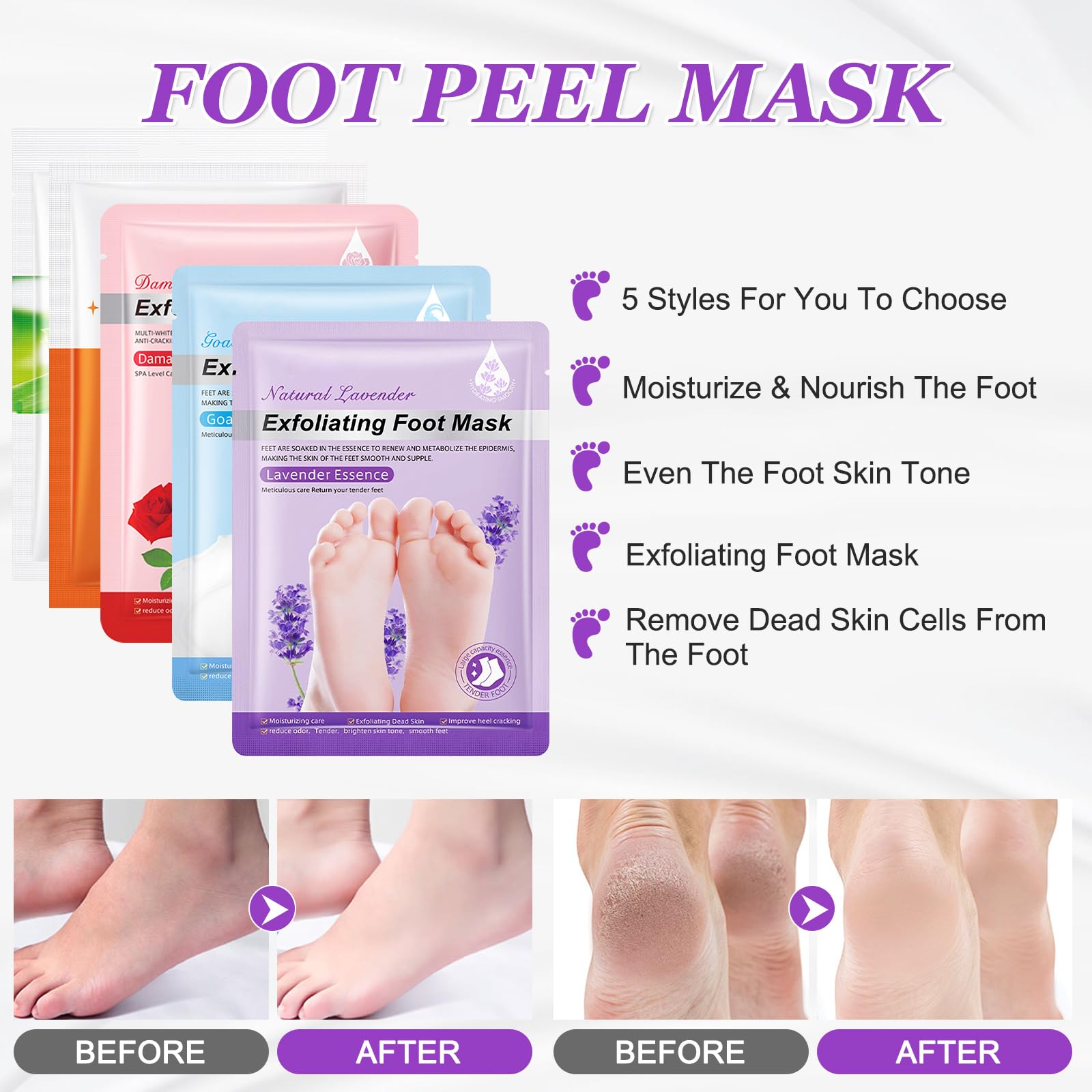 5 Paia Maschera Piedi Esfoliante, Calzini Idratanti per Piedi, Foot Peel Mask per Calli, Pelle Morta e Talloni Screpolati, Lavanda Latte di Capra Rosa Aloe Sbiancamento Foot Mask per Donne e Uomini