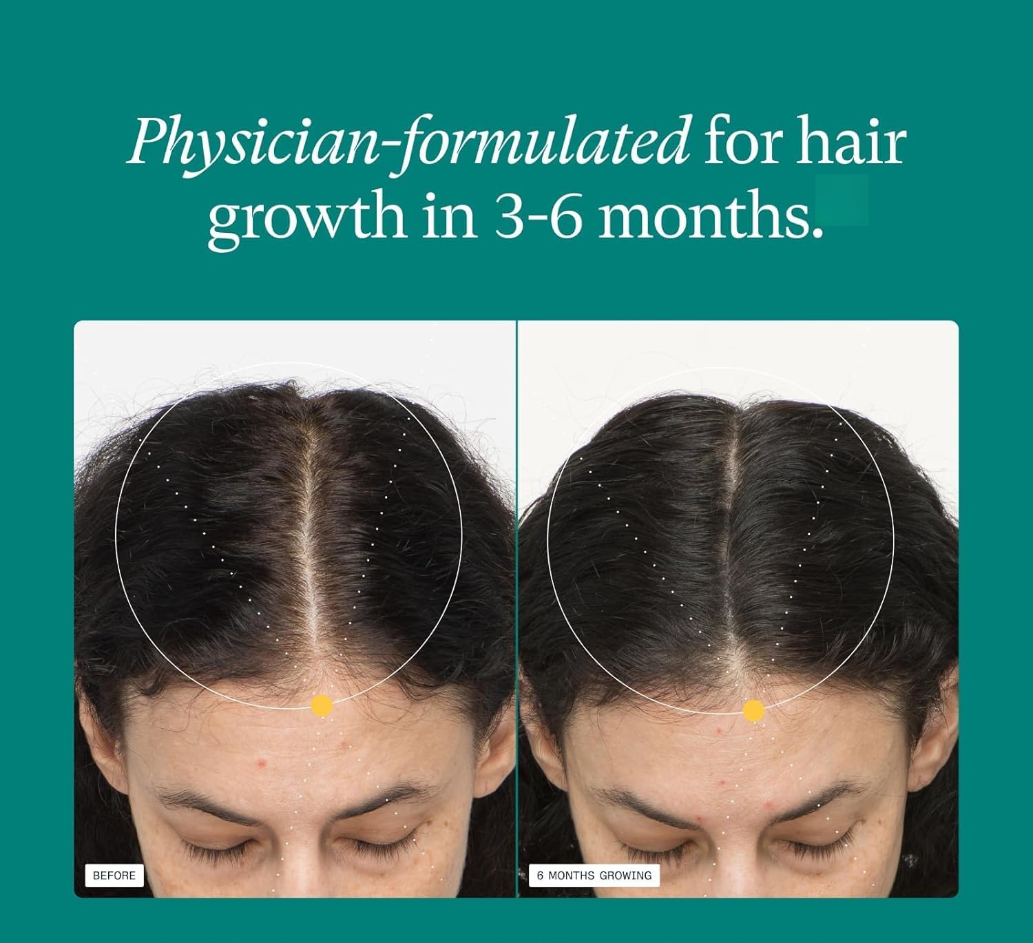Formula per la crescita dei capelli per donne - Promuove una crescita dei capelli più folta, forte e veloce