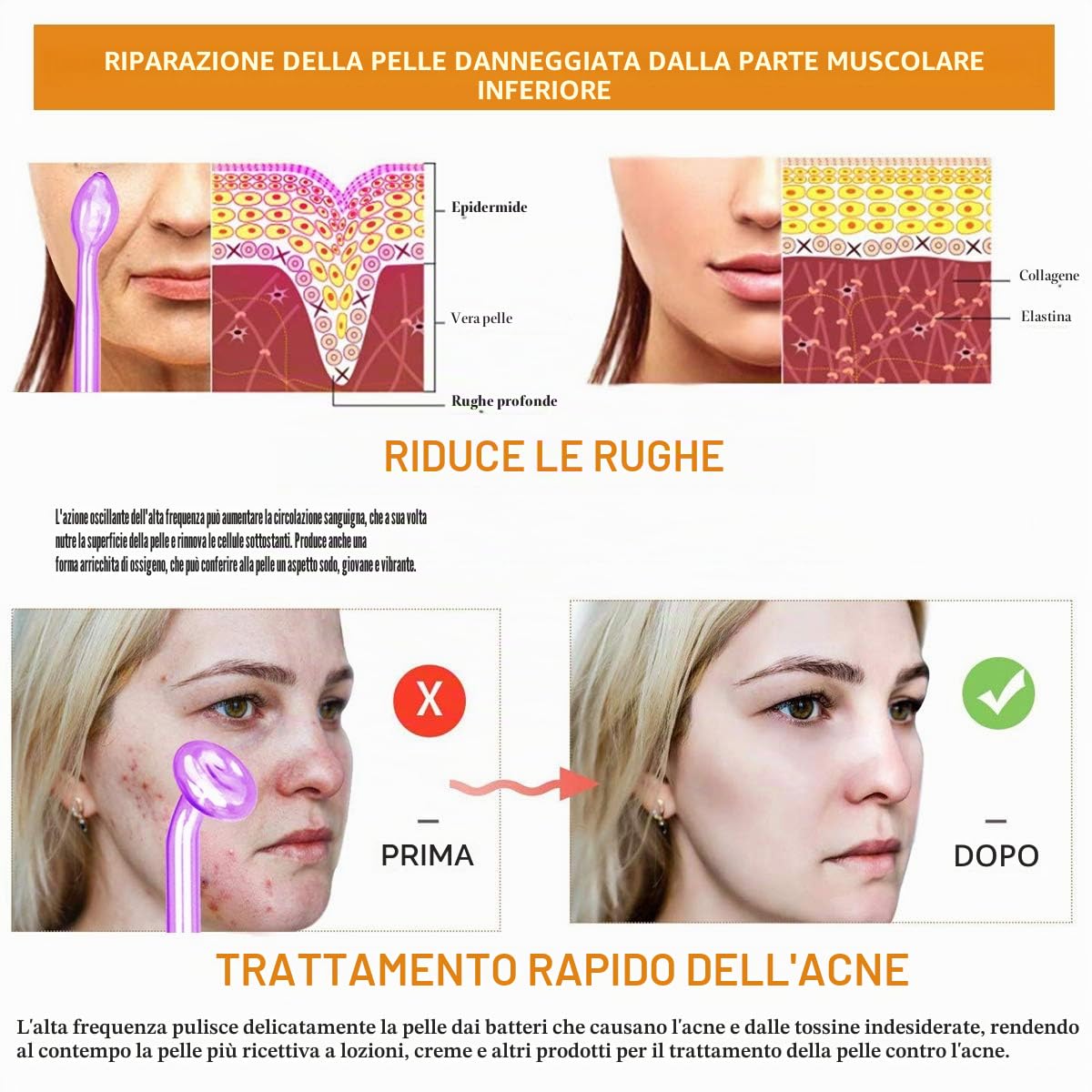 Macchina per il viso ad alta frequenza TwoWin, 6 elettrodi Argon Gas Violet e Neon Gas Arancione Bellezza Cura della pelle Acne Spot Rimozione brufolo Rimozione lifting Gonfiore Bacchetta portatile | e Neon Gas Arancione Bellezza Cura della pelle Acne Spo