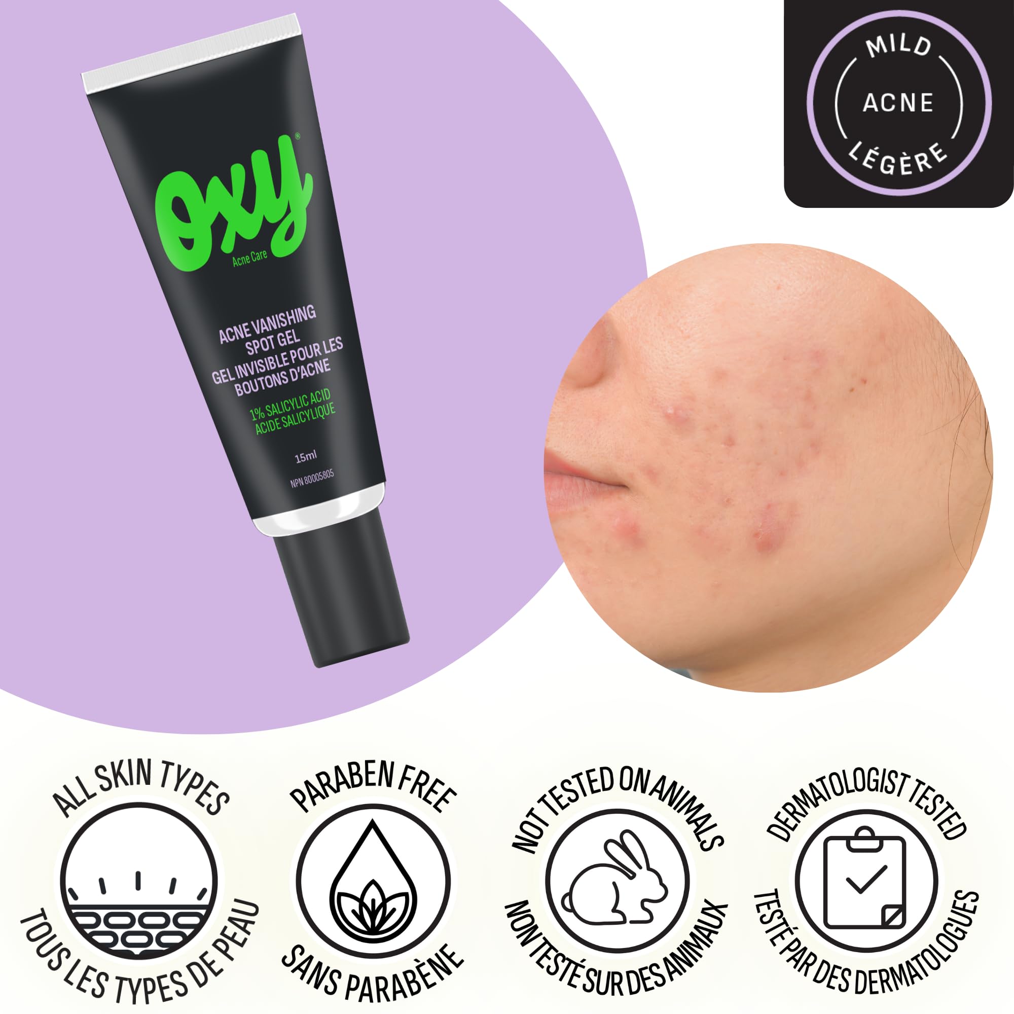 Amazon.ca: OXY Canada: Acne Solutions