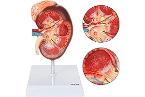 Kidney Anatomical Model with Adrenal Gland for Students, Teachers or Doctors