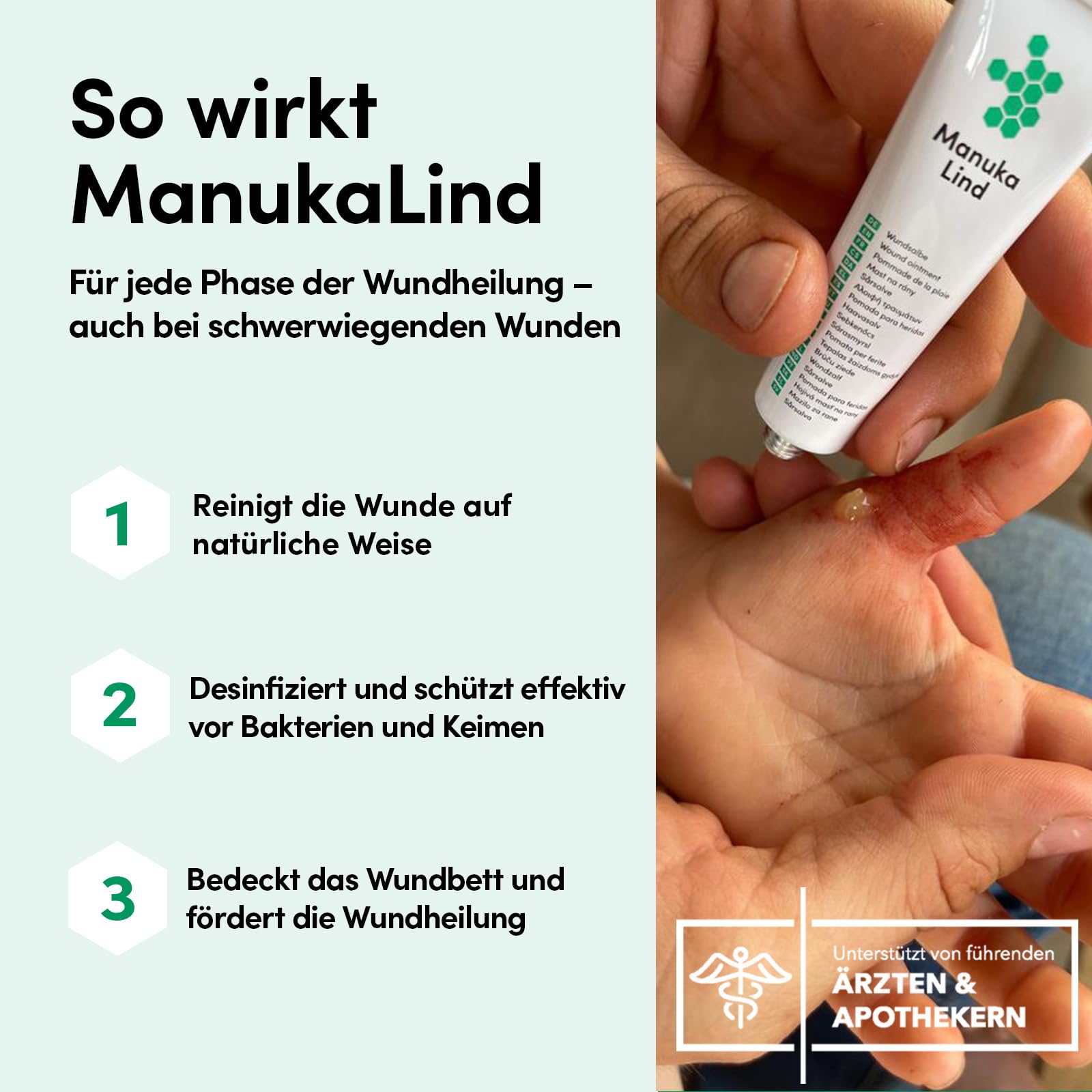 Set: 1x Wundheilspray (30ml) + 2x Wundheilsalbe (15g) | Reinigt die Wunde & unterstützt die Heilung – mit Manuka-Honig (MGO 514+) - für alle Wundphasen – auch bei schweren Wunden