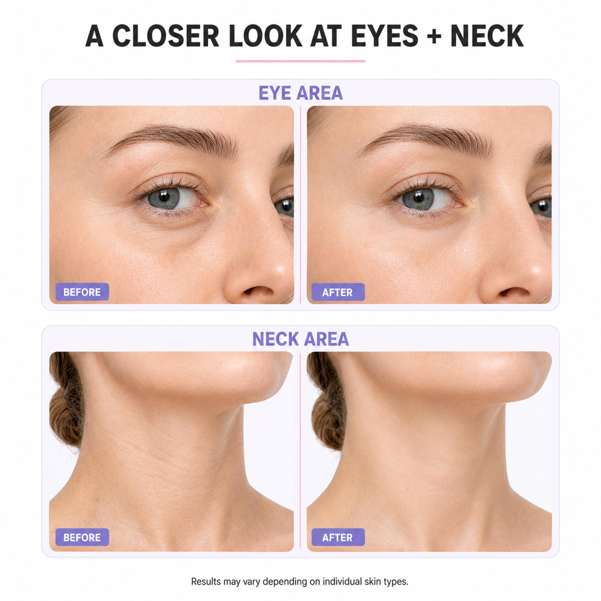 Eye Gel & Neck Cream Set, Firming Neck Moisturizer and Under Eye Gel for Puffiness, Fine Lines, Hydrating Skin Care Set for Women & Men
