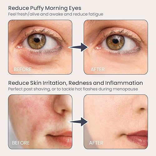 Miniatura 2 de Eli with Love Rodillo de hielo facial para cara de alta calidad con estuche de transporte y 2 rodillos para una larga duración, rodillo de ojos para