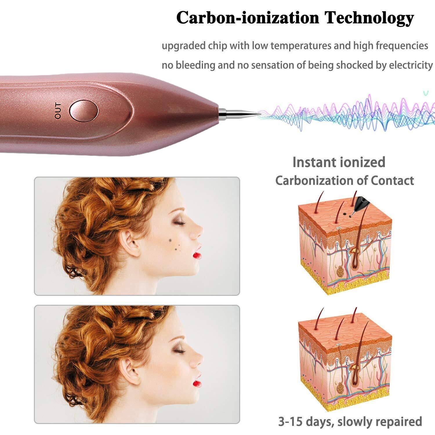 Skin Tags Remover Pen, VOONEEN Mole Remover with 9 Strength Levels &LED Spotlight, Portable