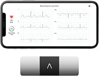 Kardia Mobile ECG