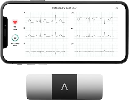 KardiaMobile 6-Lead EKG Monitor