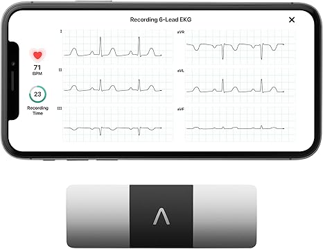 KardiaMobile 6-Lead Personal EKG Monitor