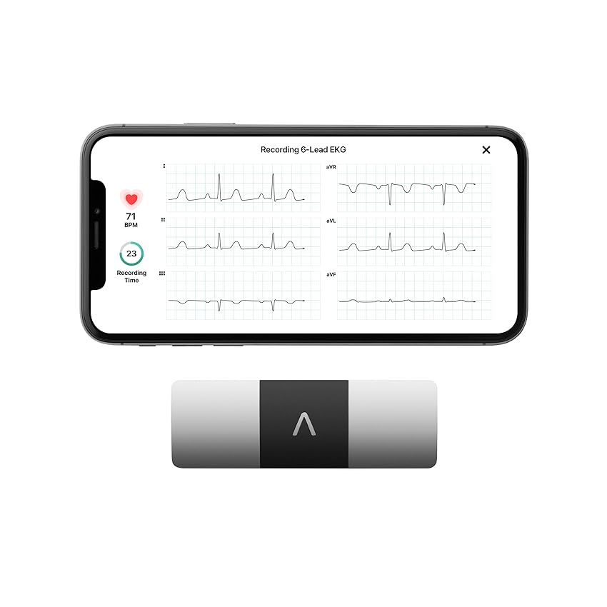 Immagine del prodotto AliveCor KardiaMobile 6L ECG Portatile, L’Elettrocardiografo Personale a 1 o 6 Derivazioni per Smartphone, Rileva la Fibrillazione Atriale in Soli 30 Secondi, Distribuito da OMRON