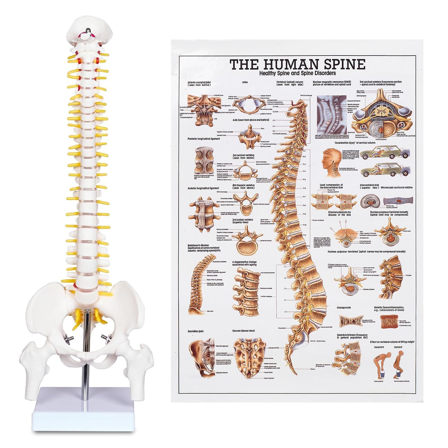 Human Spine Model - Anatomy for Medical Students -1