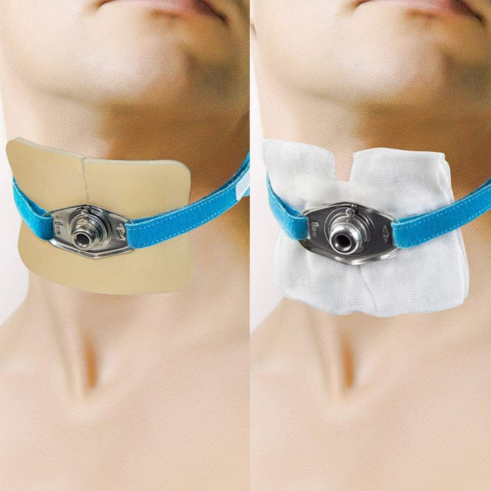 Tracheotomie-Tubenbefestigungsgurt – verstellbare Tracheostomiebänder, Krankenhausbedarf, 3 Stück