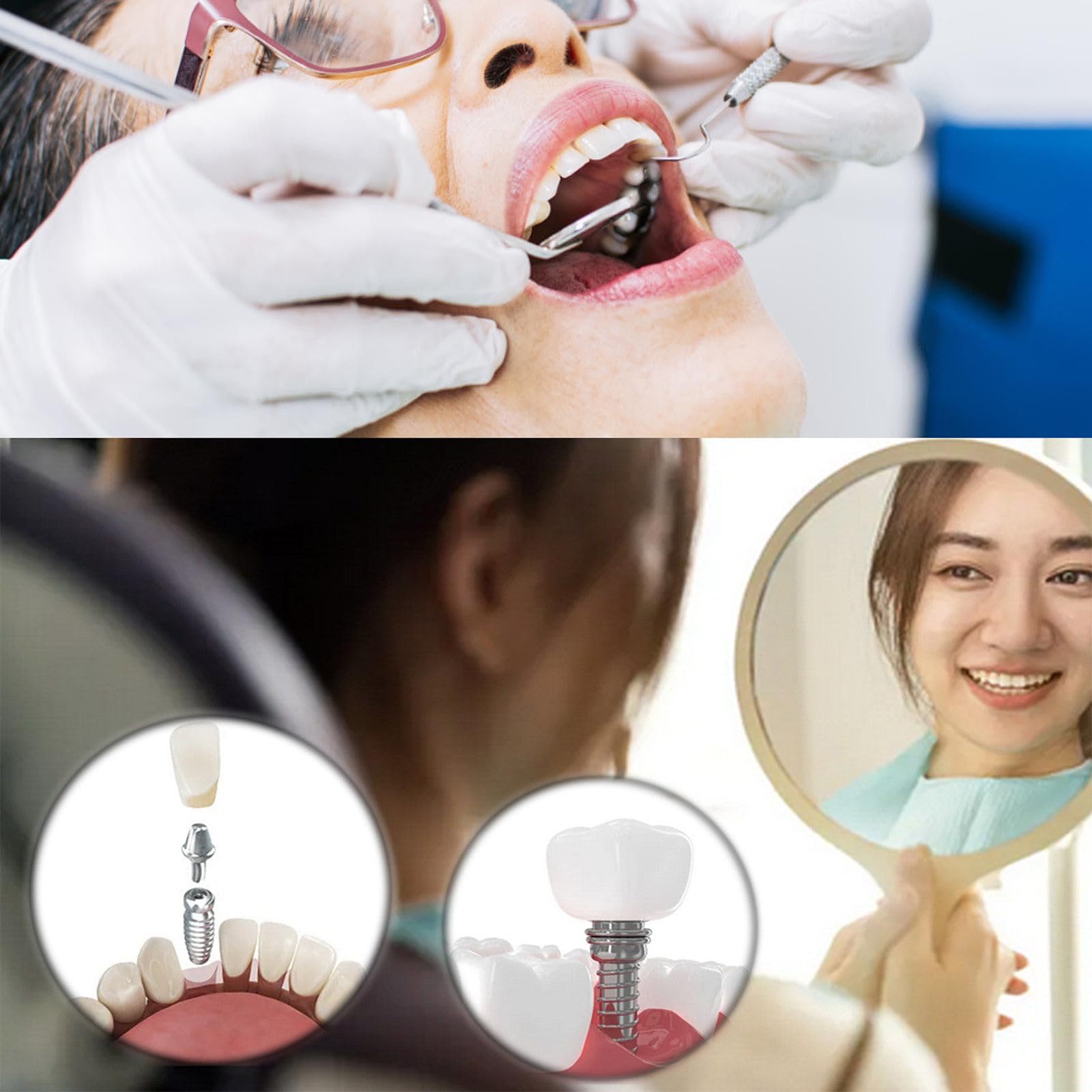 Kit di Strumenti dentali universali per Chiavi dinamometriche in Acciaio Inossidabile per Vari sistemi implantari - Impugnatura ergonomica Antiscivolo
