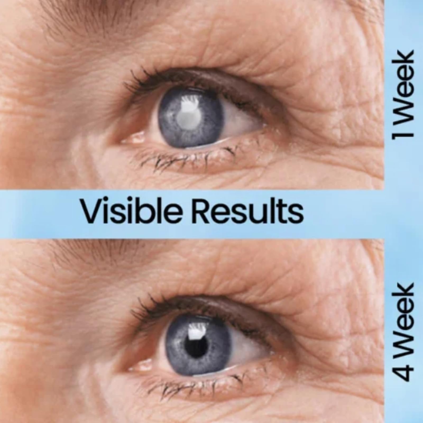 Gouttes Pour Les Yeux Isotine – Cure Cataracte Et Glaucome, Naturel, Neuf Péremption 01/2026