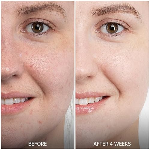 Miniatura 2 de VGO Suero de retinol para cara, suero de retinol rejuvenecedor con ácido hialurónico, niacinamida y ceramidas, hidratante y refrescante, suavizante