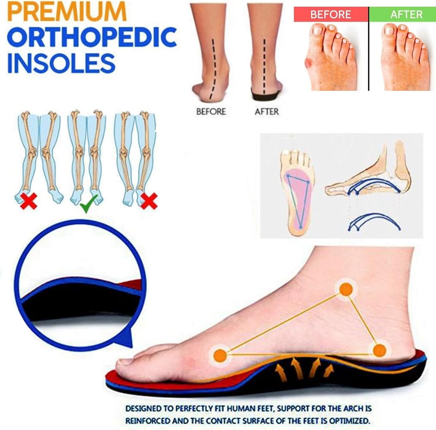 Mules for Women with Arch Support Comfortable Slip On Closed Toe Sandals Orthopedic Diabetic Slippers Casual Wedge Platform Slipper No Slip Walking Clogs for Indoor Outdoor - Image 5