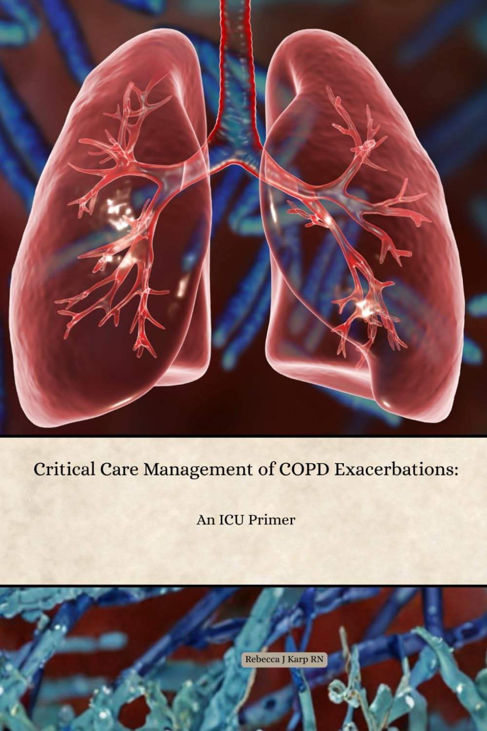 Critical Care Management of COPD Exacerbations: An ICU Primer