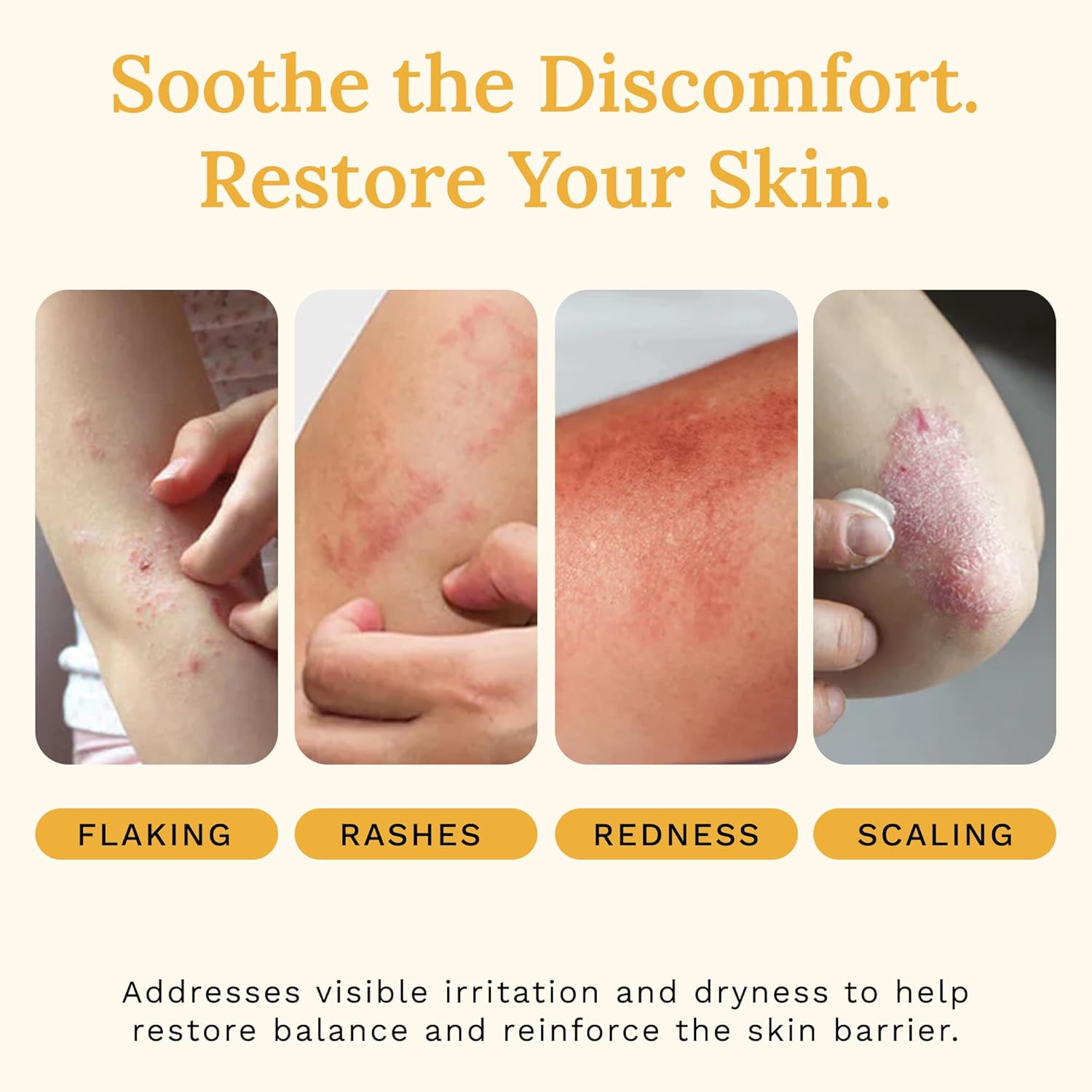 Rejuvaskin Skin Recovery Cream with Aloe Vera, Eczema Relief Cream for Dry, Itchy & Sensitive Skin, Hydrating & Cooling Moisturizer, Radiation Relief Cream, 100 ml