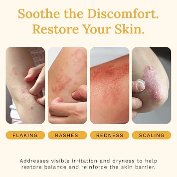 Rejuvaskin Skin Recovery Cream with Aloe Vera, Eczema Relief Cream for Dry, Itchy & Sensitive Skin, Hydrating & Cooling Moisturizer, Radiation Relief Cream, 100 ml - Pack of 10