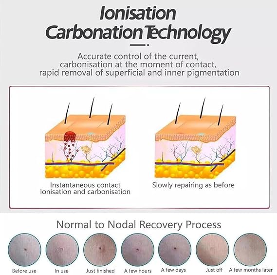 BODYA 9 Levels Laser Plasma Pen Mole Removal Dark Spot Remover Skin Wart Tag Tattoo Removal