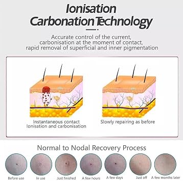 BODYA 9 Levels Laser Plasma Pen Mole Removal Dark Spot Remover Skin Wart Tag Tattoo Removal