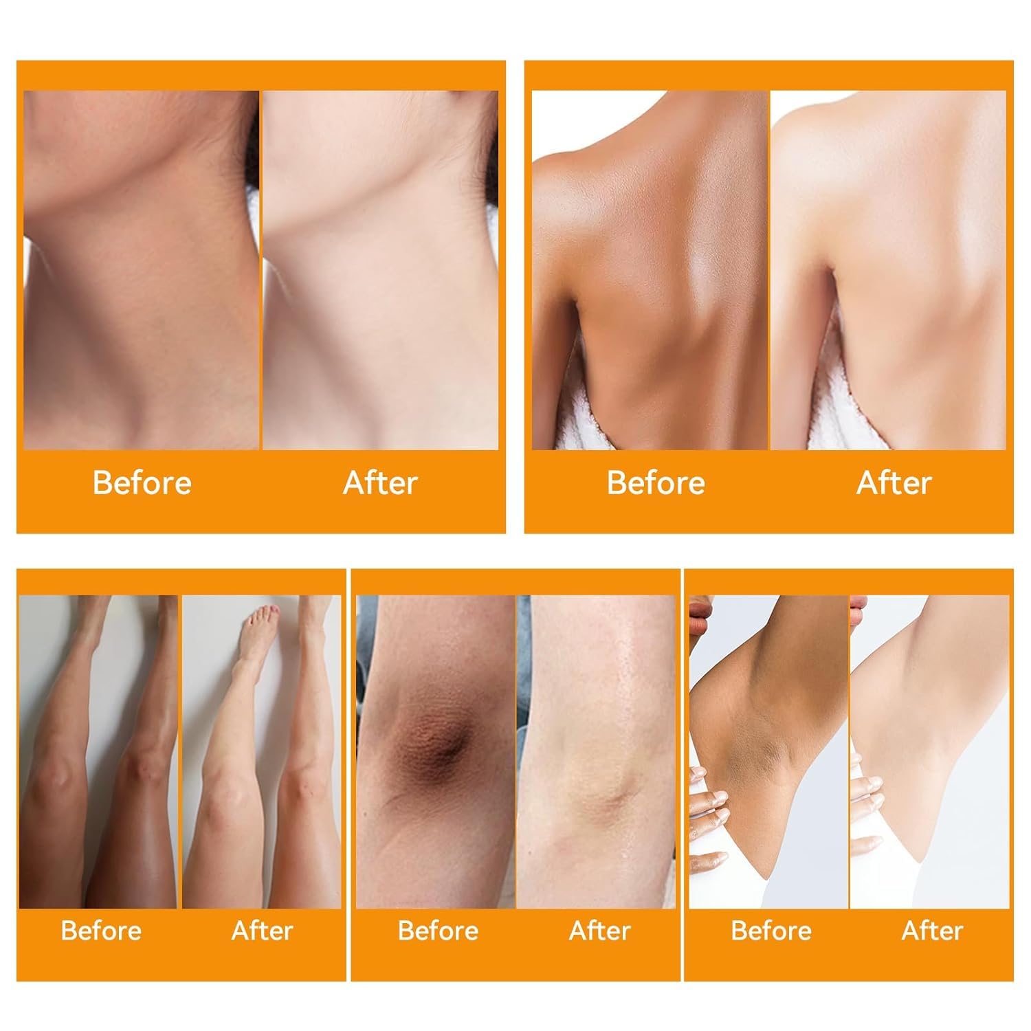 Dark Knees Remover Underarm Cream Body Moisturizer Lotion Dark Toe Knuckles Treatment Removal Remover Corrector for Armpit Elbow Inner Thigh Neck Private Part Intimate Legs Skin Cream - 120g/4.21oz - Image 5