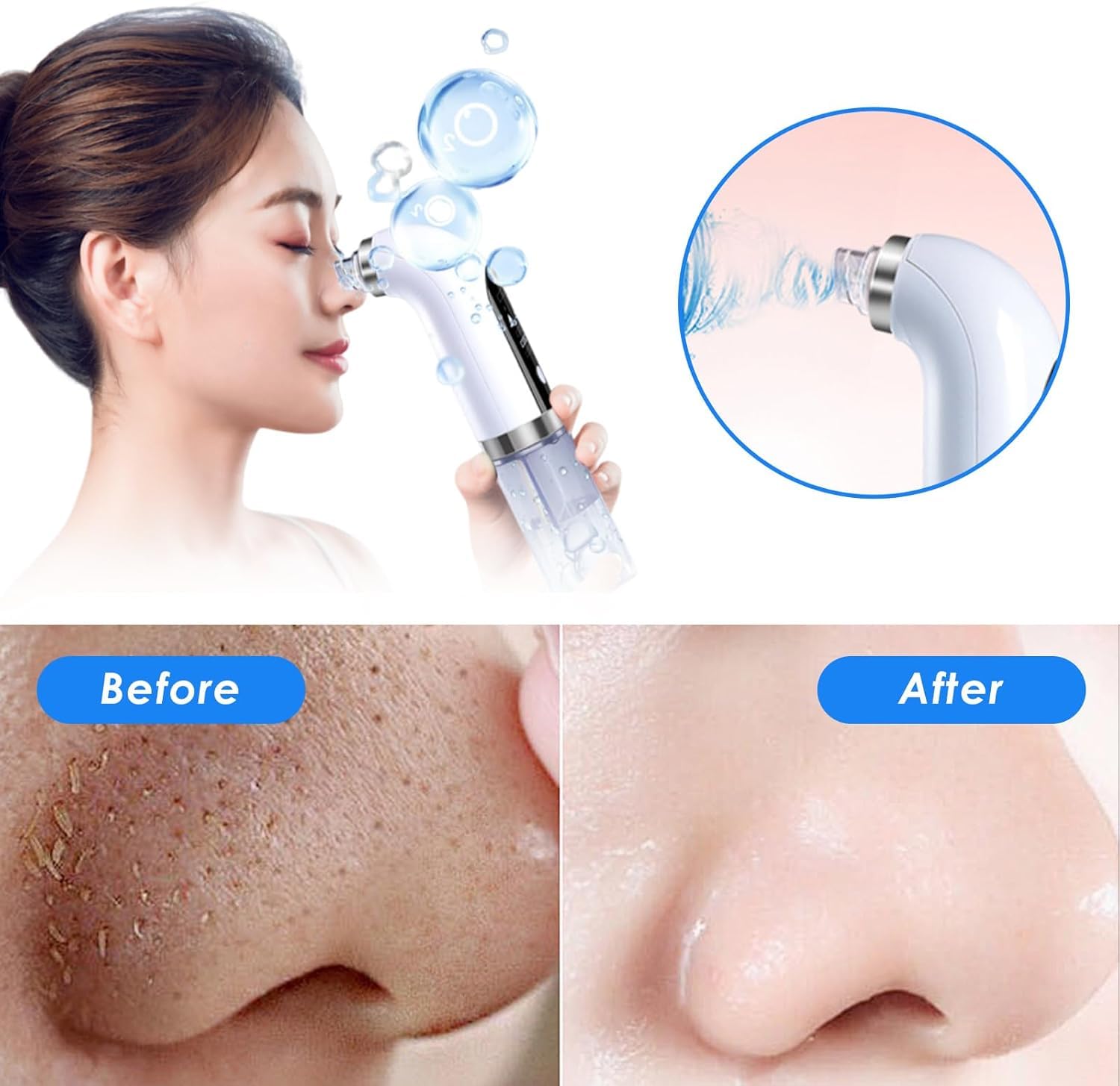Aspirateur Points Noirs, Extracteur Points Noirs Visage, 4 Modes, 6 Sondes, 75 kPa Super puissance, Tire Comedon Points Noirs Anti Point Noir Nez Nettoyage des Pore Peau Soin Visage Blackhead Removal
