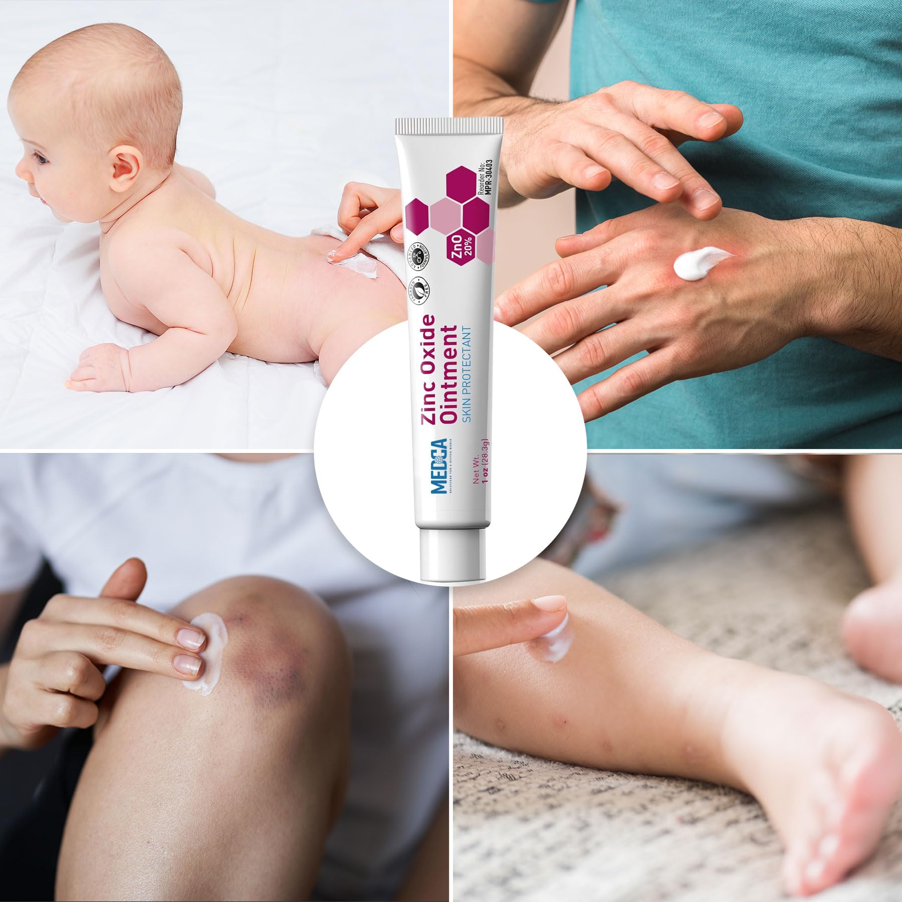 High-Potency 20% Zinc Oxide Ointment - (Pack of 4) Baby Diaper Rash Cream and Gentle Skin Protectant Barrier for Chafed Skin, Wetness, Daily & Overnight Protection Soothing, Hypoallergenic, 1oz Tubes