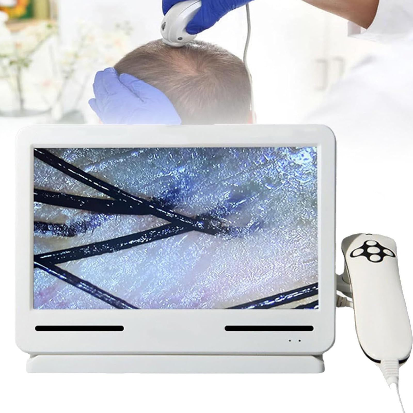 Analizador De Cabello Profesional para Diagnóstico De Piel, Detector De Cuero Cabelludo De 10,1 Pulgadas, Microscopio Capilar, Detector De Piel/Folículo Piloso/Cuero Cabelludo