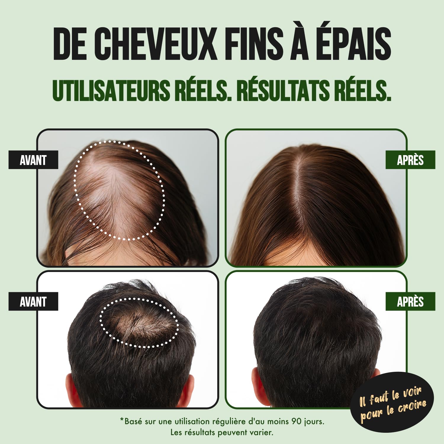 Serum Pousse Cheveux Spray | Favorise la Pousse des Cheveux très rapide | Huile Pousse Cheveux Spray de la Biotine, Caféine, de l'huile de Ricin et de l'Aminexil (3 mois d'utilisation)