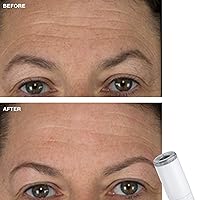 Vista 6 de Trophy Skin Punta de diamante estándar, compatible con cualquier máquina de microdermoabrasión Trophy Skin - Accesorio de calidad profesional