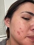 Review Image by Napoooo