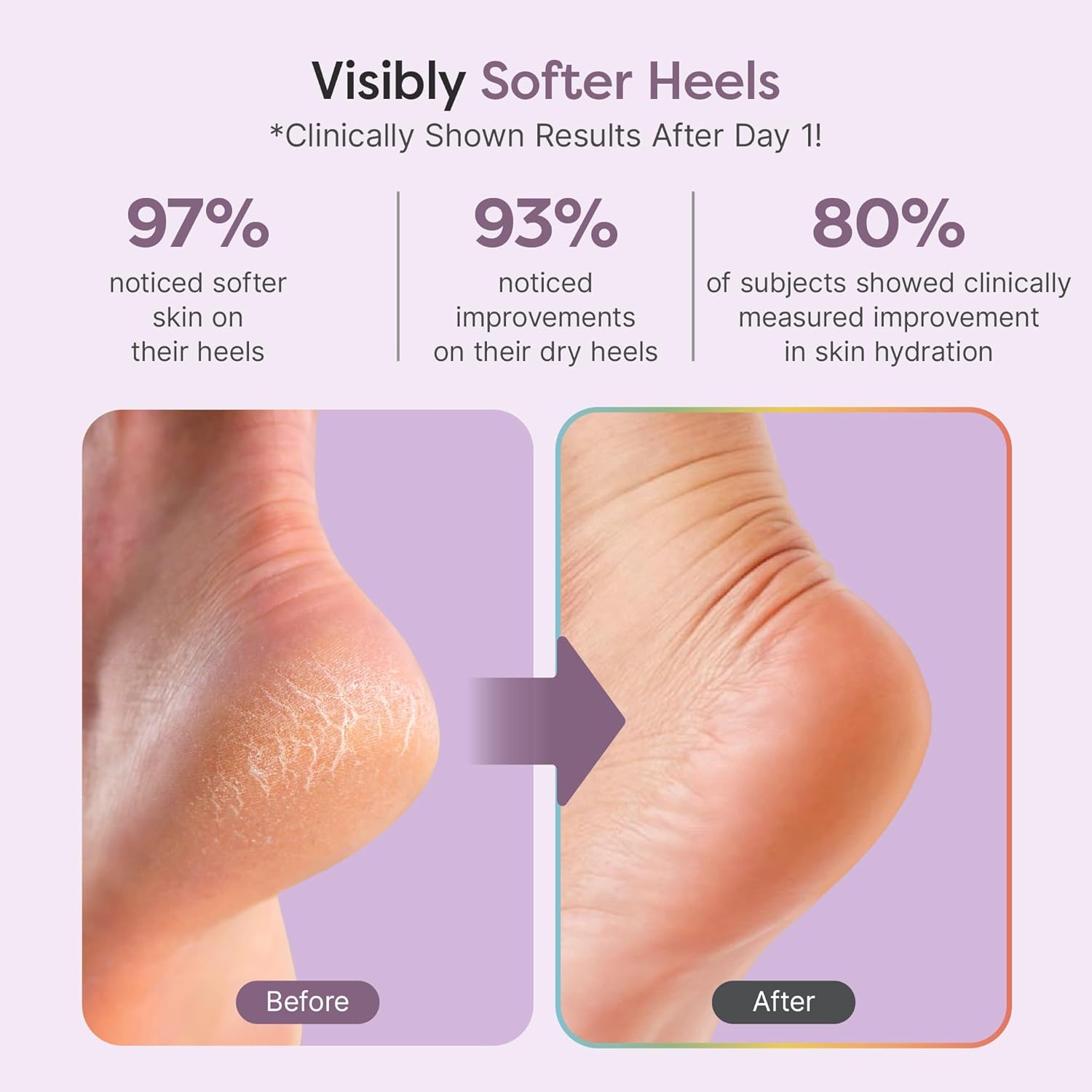 ZenToes Natural Foot Balm | Hydrating Cream for Dry, Cracked Heels & Feet | Enriched with Coconut, Tea Tree, Jojoba & Vitamin E Oils | Soothes & Softens Rough Skin | 2oz - Image 2