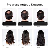 Vista 4 de Champú de minoxidil y biotina para el crecimiento del cabello, enriquecido con cafeína, aceite de ricino y cebolla, bloqueador DHT para un cabello