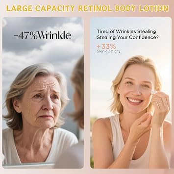300ml Retinol Body Lotion, Advanced Retinol Cream, Large-capacity Retinol Firming Body Cream with Cocount Oil and Vitamin E, Remove Dark Spots, Moisturizing Body Lotion for Dry Skin, Smooth Body Skin