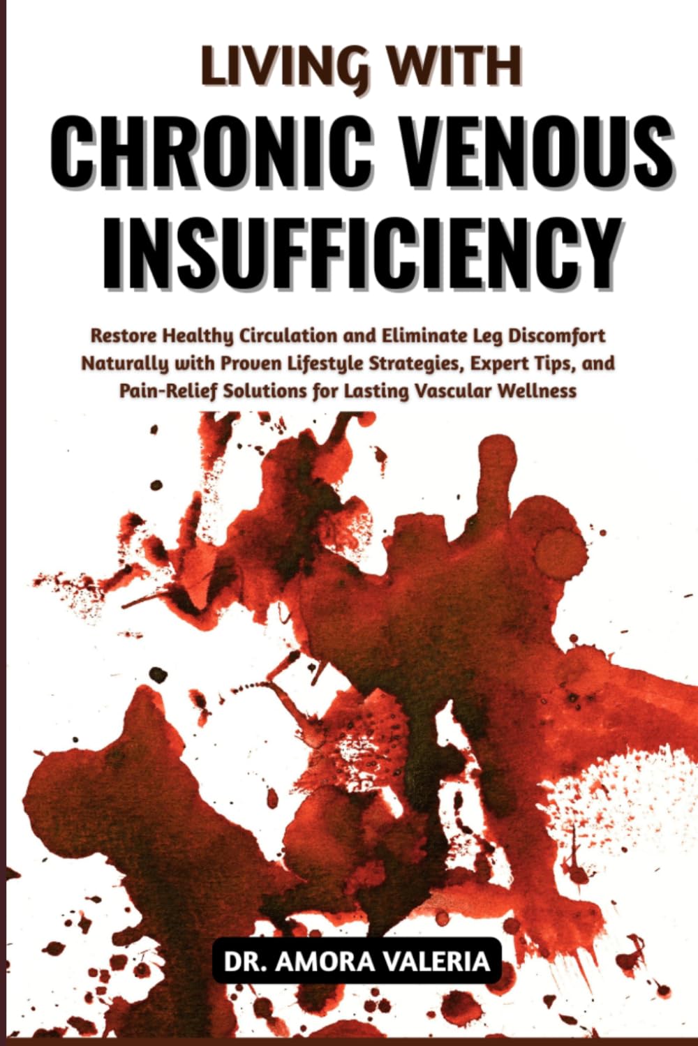 Living With Chronic Venous Insufficiency: Restore Healthy Circulation and Eliminate Leg Discomfort Naturally with Proven Lifestyle Strategies, Expert ... Solutions for Lasting Vascular Wellness
