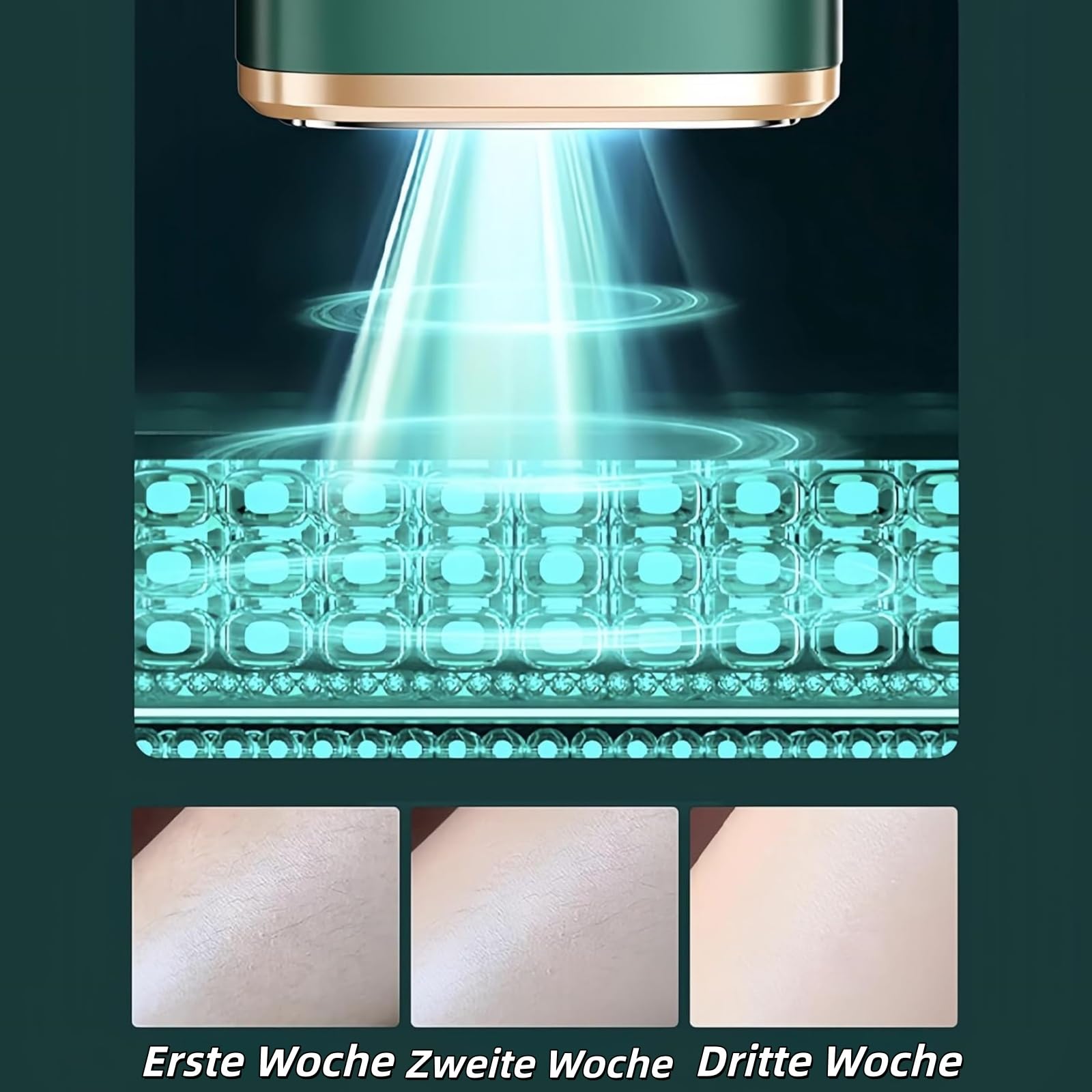 IPL Geräte Haarentfernung Laser mit Gefrierfunktion, Schmerzfreie Haarentfernungsgerät,Geräte Haarentfernung mit Saphir-Eis, Lichtimpulse und Energiestufen für Körper, Gesicht, Bikini (Dunkelgrün)