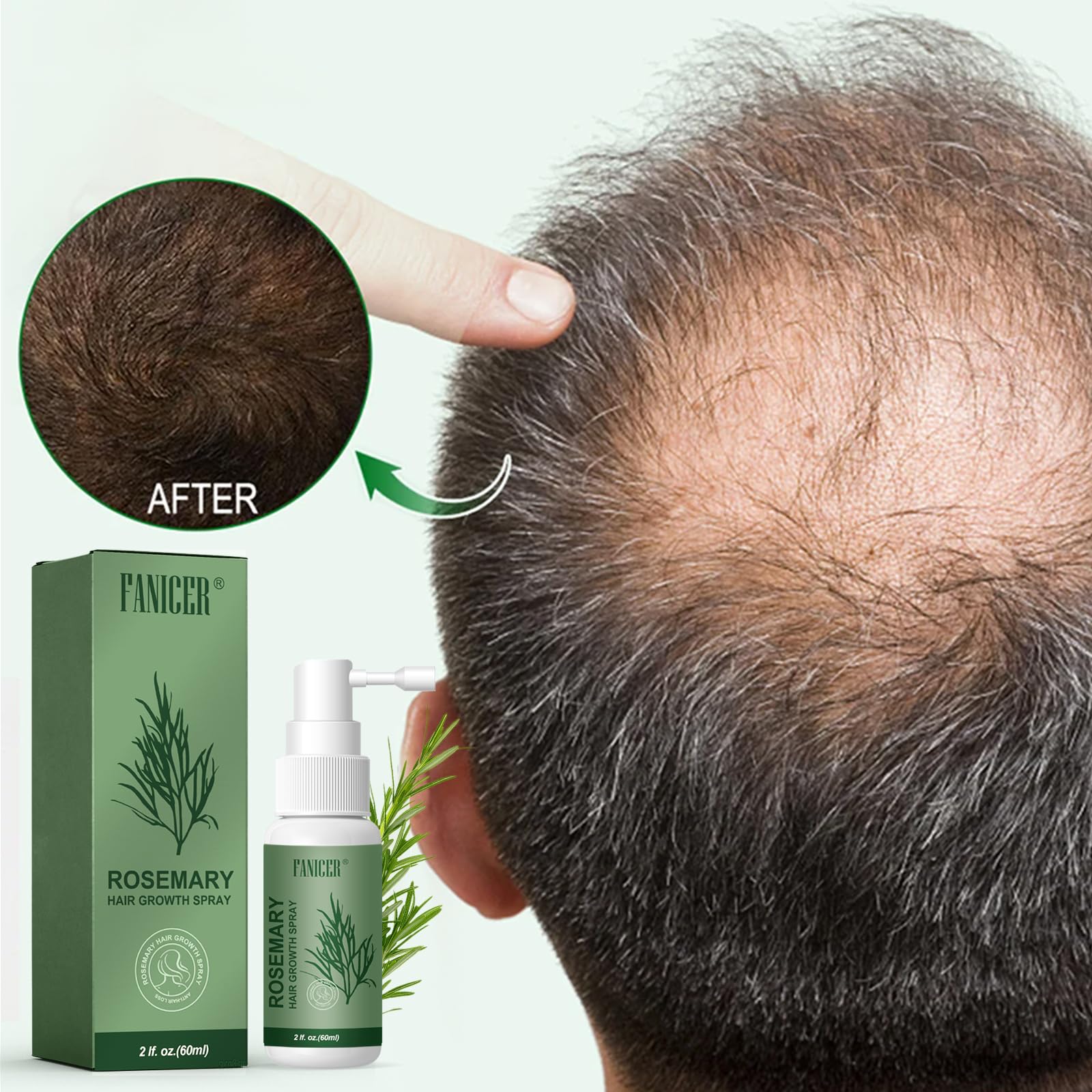 Serum Pousse Cheveux,Spray à Huile Essentielle De Romarin Pour La Croissance Des Cheveux,Growth Hair Oil,Huile de Pousse Cheveux Très Rapide,pour les Femmes et les Hommes (60ml)