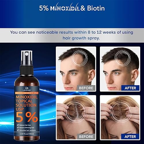 Miniatura 3 de 5% de minoxidil para hombres y mujeres, spray para el crecimiento de la barba y el cabello con biotina, suero de crecimiento del cabello de