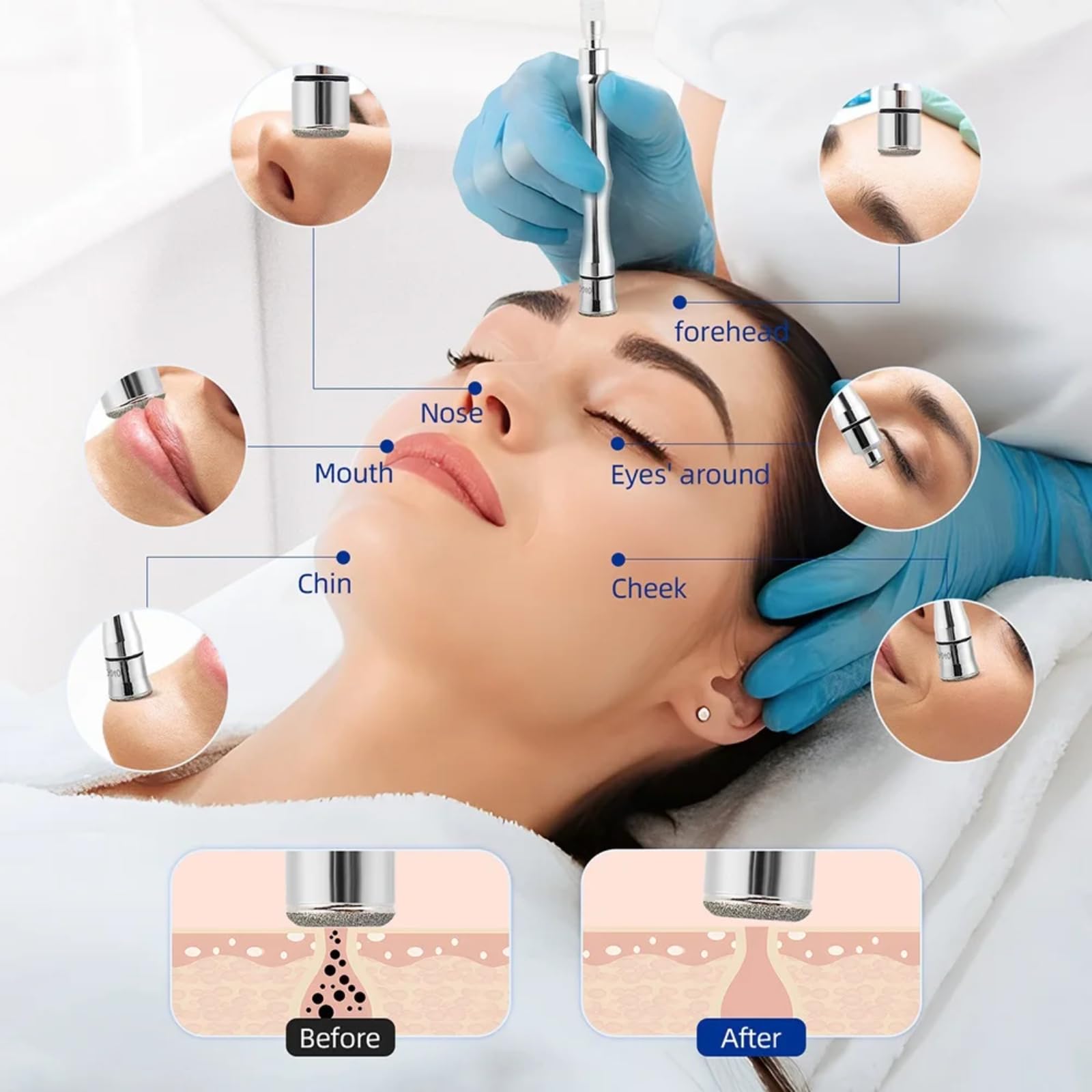 Mikrodermabrasion Diamant Spitzen, Diamant Dermabrasion Ersatz, 9 Stück Diamant Mikrodermabrasions Dermabrasionsspitzen mit Griff Edelstahl Filterset für Mikrodermabrasions Schönheitsmaschine