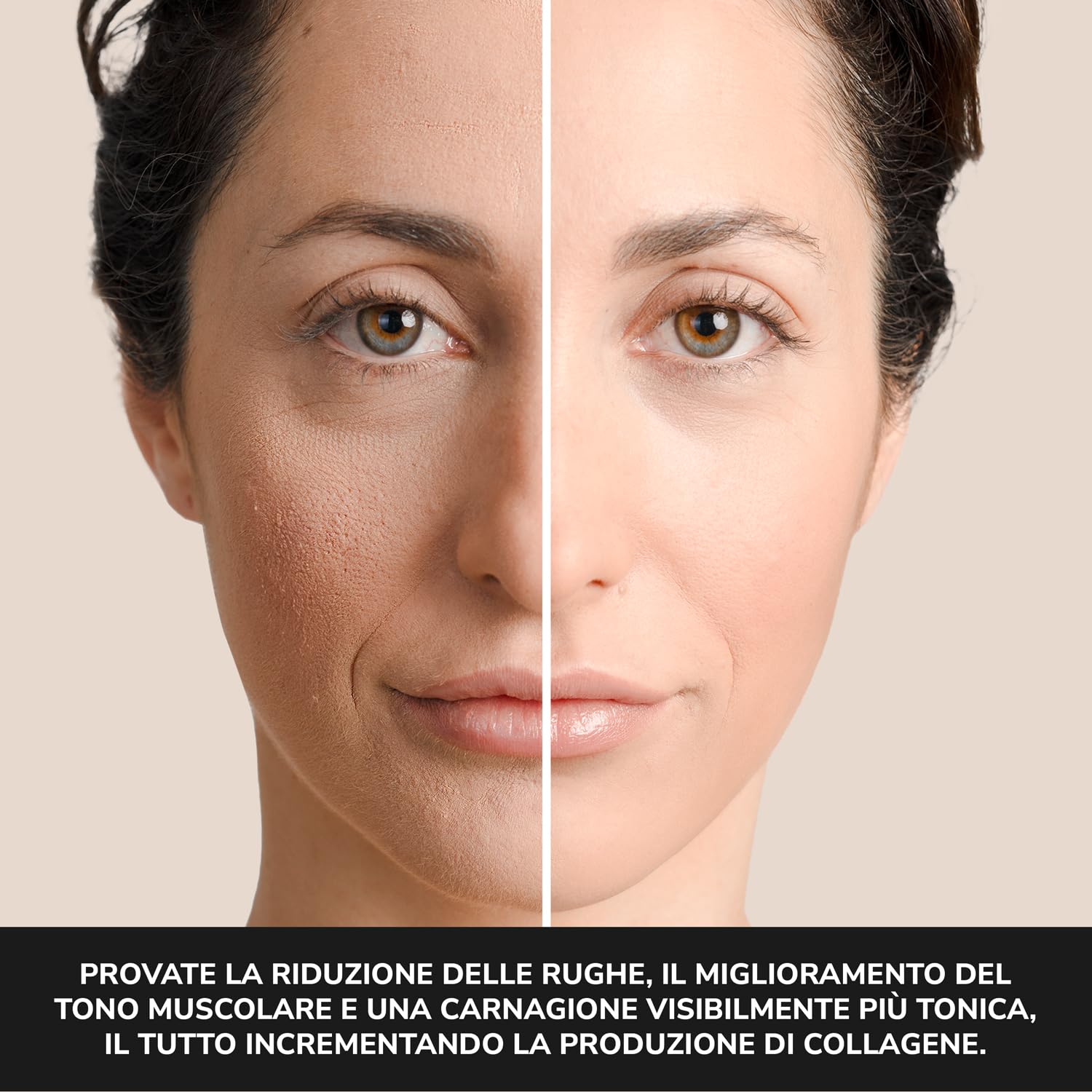 Illume 2nd Gen Radiofrequenza viso et Massaggiatore Viso, Dispositivo antirughe con radiofrequenza viso professionale per Lifting Viso e Cura Anti-età