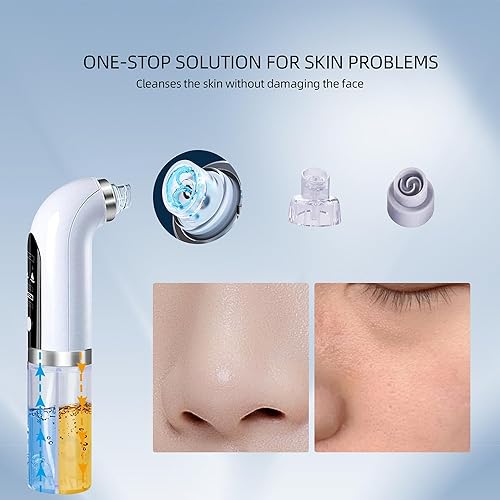 Miniatura 4 de Aspiradora eléctrica para eliminar puntos negros, herramienta facial de limpieza profunda para piel grasa y propensa al acné, recargable por USB,