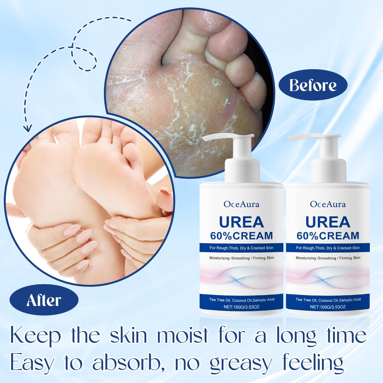 Crema Urea 2PCS, Urea Piedi, Piedi Arricchita con, Crema piedi secchi screpolati, per Mani, Talloni, Gomiti, Unghie e Ginocchia