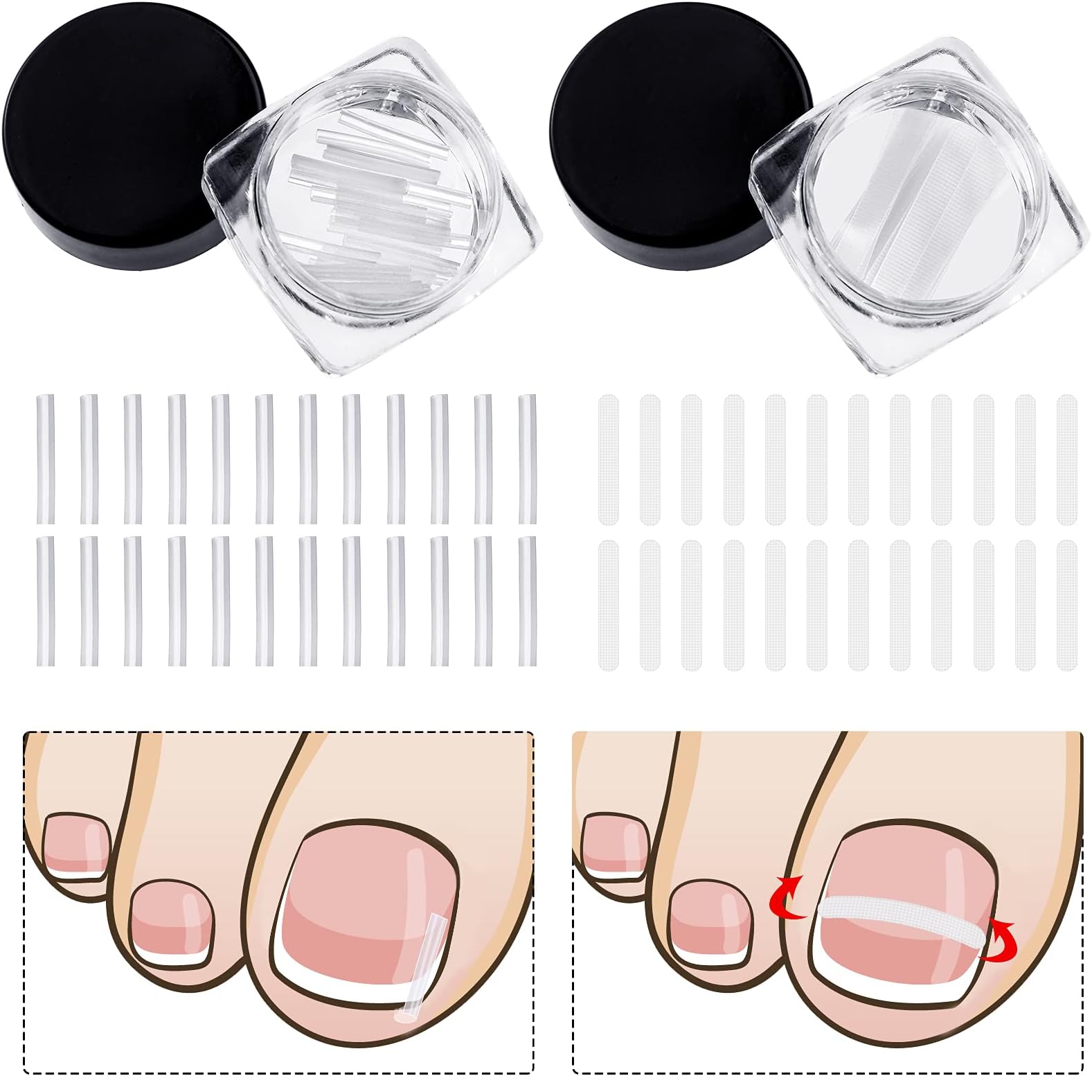 60 Pieces Ingrown Toenail Corrector Strips Ingrown Toe Nail Correction Brace Correction Clip Toe Nail Straightening Recover Patch Curved Toenail Corrector for Women Men Foot Care, 2 Styles